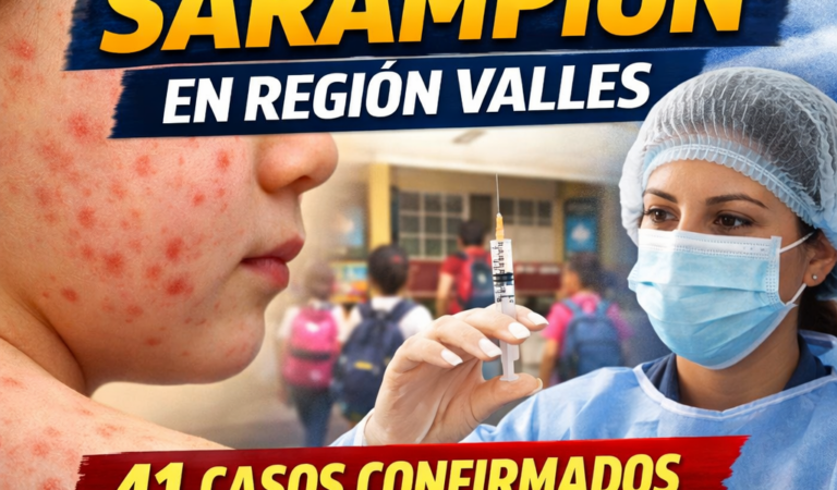 Tala encabeza casos de sarampión en la Región Valles